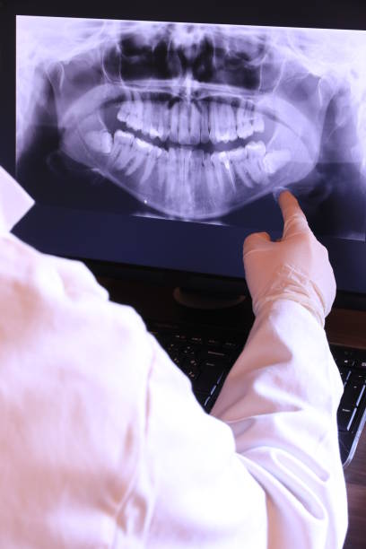 Best Dental Abscess Treatment in Antigo, WI