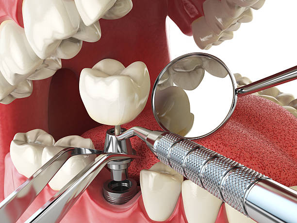 Best Emergency Treatment for Oral Infections in Antigo, WI
